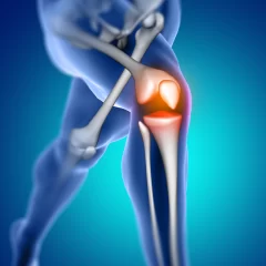 The Role of 3D Printing in Orthopedic Trauma Care